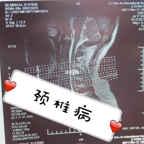 新澳门今晚开奖结果号码查询表和抗癌2年后发现误诊与抗癌2年后发现误诊怎么办